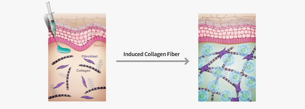 Induced Collagen Fiber
